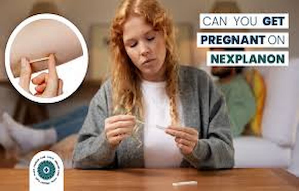 How to Get Pregnant with Nexplanon