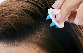 How to Open Hair Follicles on the Scalp Naturally